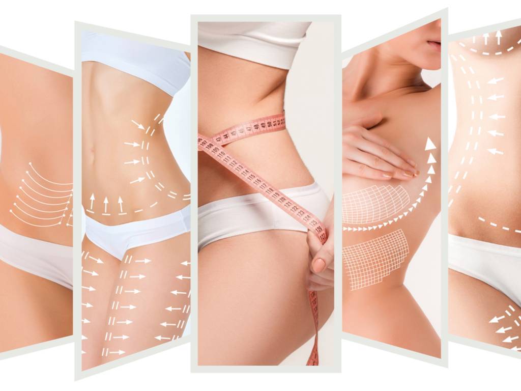 Was ist Post–Bariatrische Chirurgie?